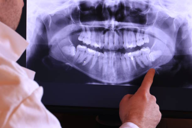 Best Emergency Gum Treatment in Benson, AZ